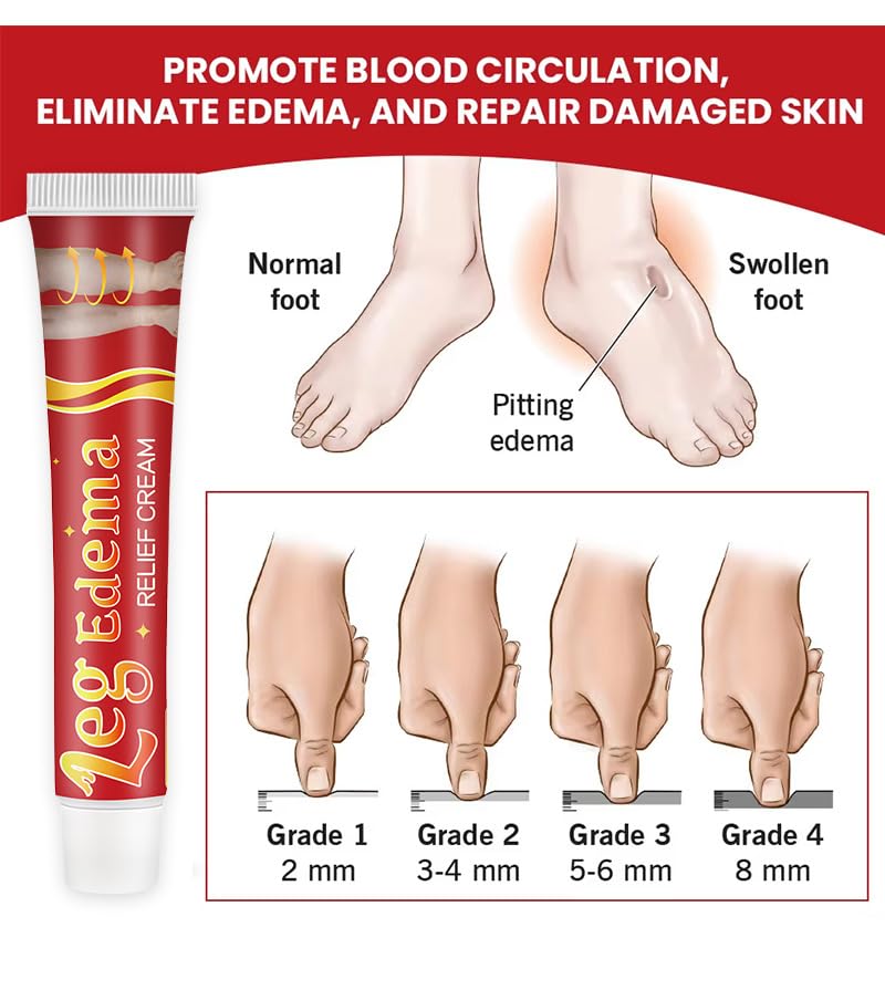 Leg Slimming Massage Cream | Soothing Swelling, Tightening Skin, Auxiliary Care for Reducing Edema （2 Pieces） bobojuju Au supplements