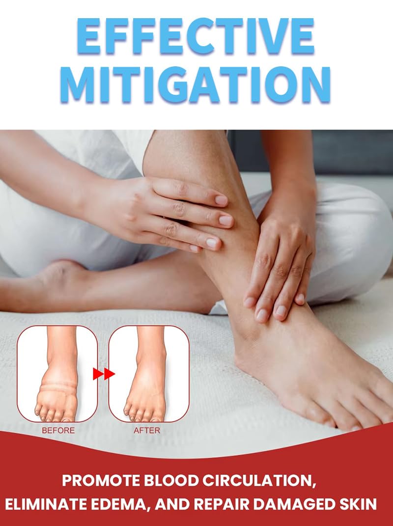 Leg Slimming Massage Cream | Soothing Swelling, Tightening Skin, Auxiliary Care for Reducing Edema （2 Pieces） bobojuju Au supplements