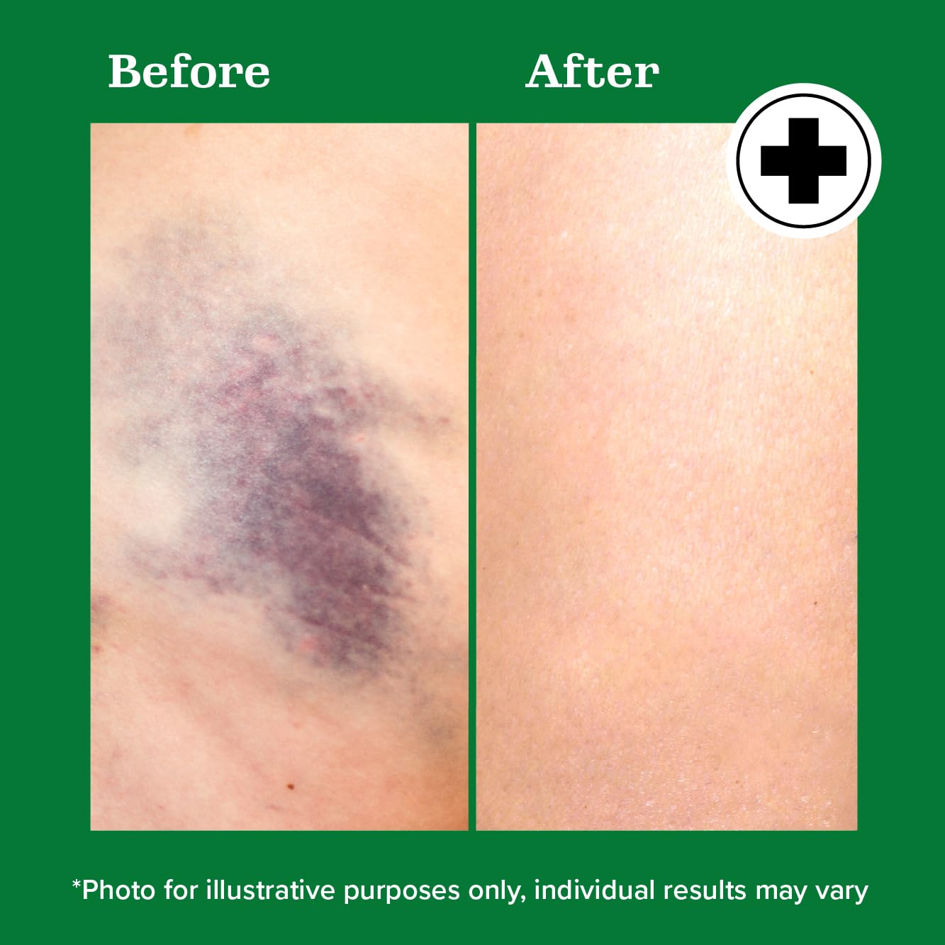 Miracle Plus Arnica Bruise Relief Gel + Magnesium Leg Relief Cream Bundle Miracle Plus Au supplements