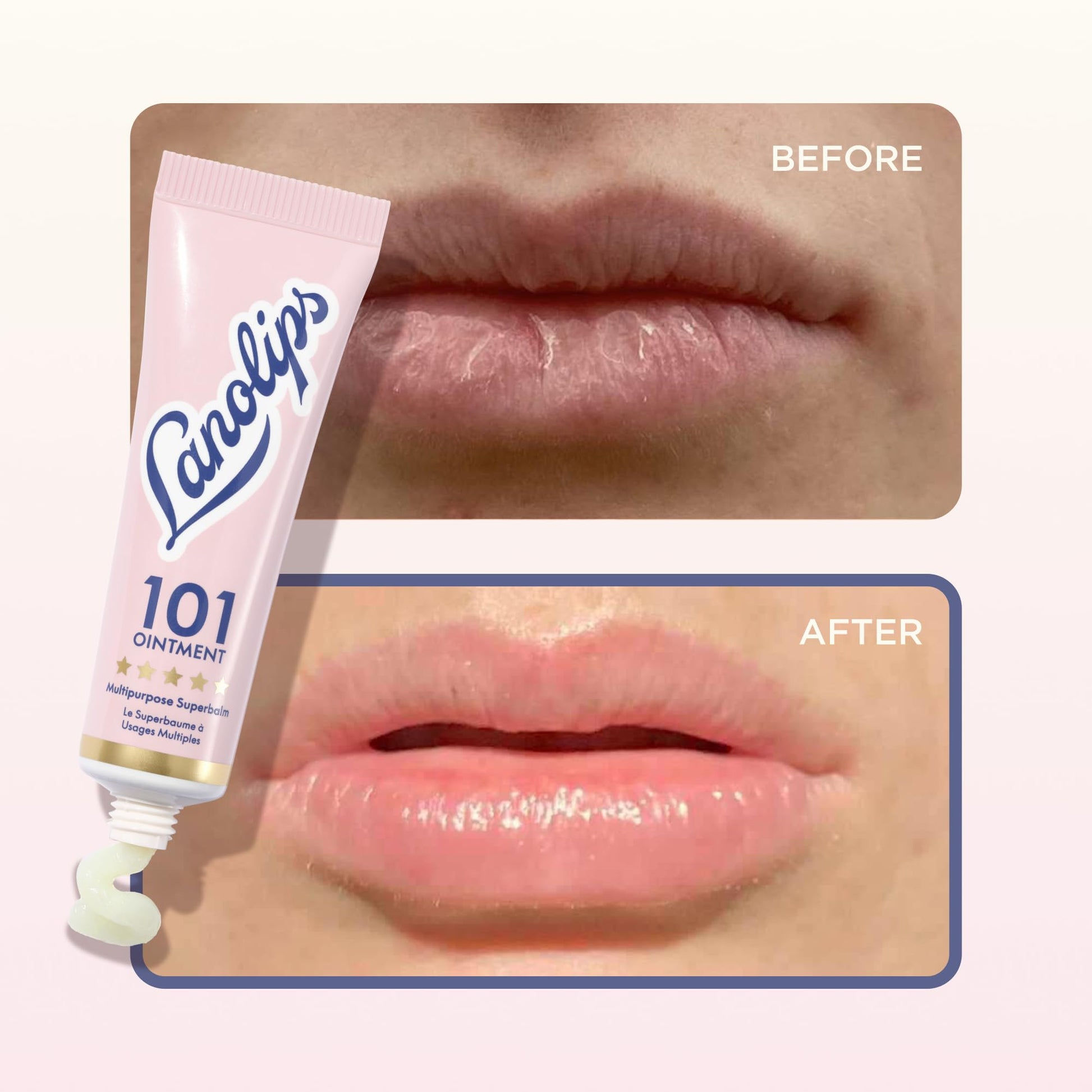 Lanolin 101 Multipurpose Ointment - Lanolin Lip Balm & Healing Ointment for Skin Barrier Repair - Moisturizer for Dry Lips, Cuticles & Elbows - No Petroleum Formula - Original Superbalm (0.52 oz) Lanolips Au supplements