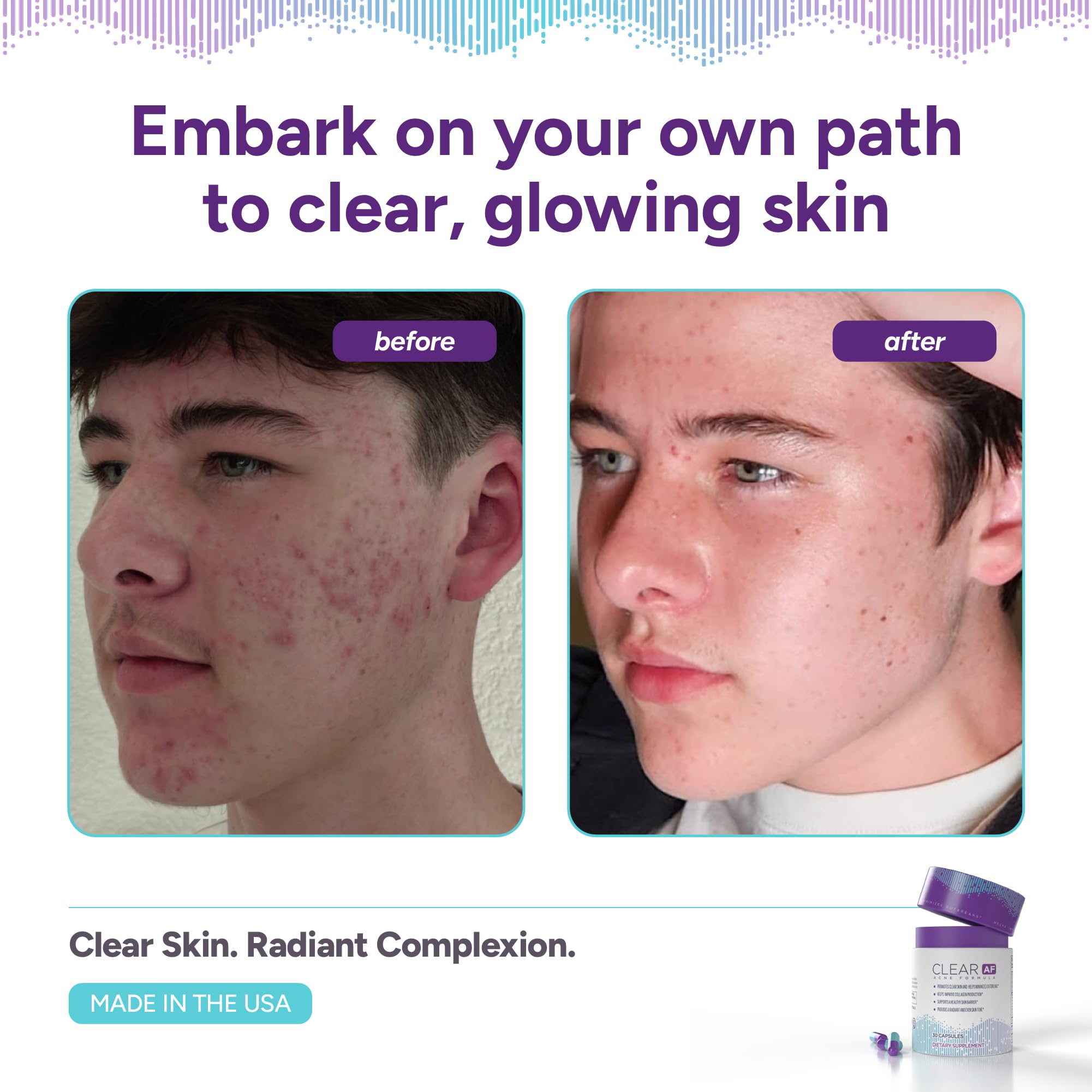 Clear AF Clear Skin Supplement | Skin Barrier Hydration & Clear Complexion Support with Vegan Ceramides, Zinc, Vitamin D3, B6, Riboflavin & Thiamine | Vegan Capsules | 30-Day Supply Clear AF Au supplements