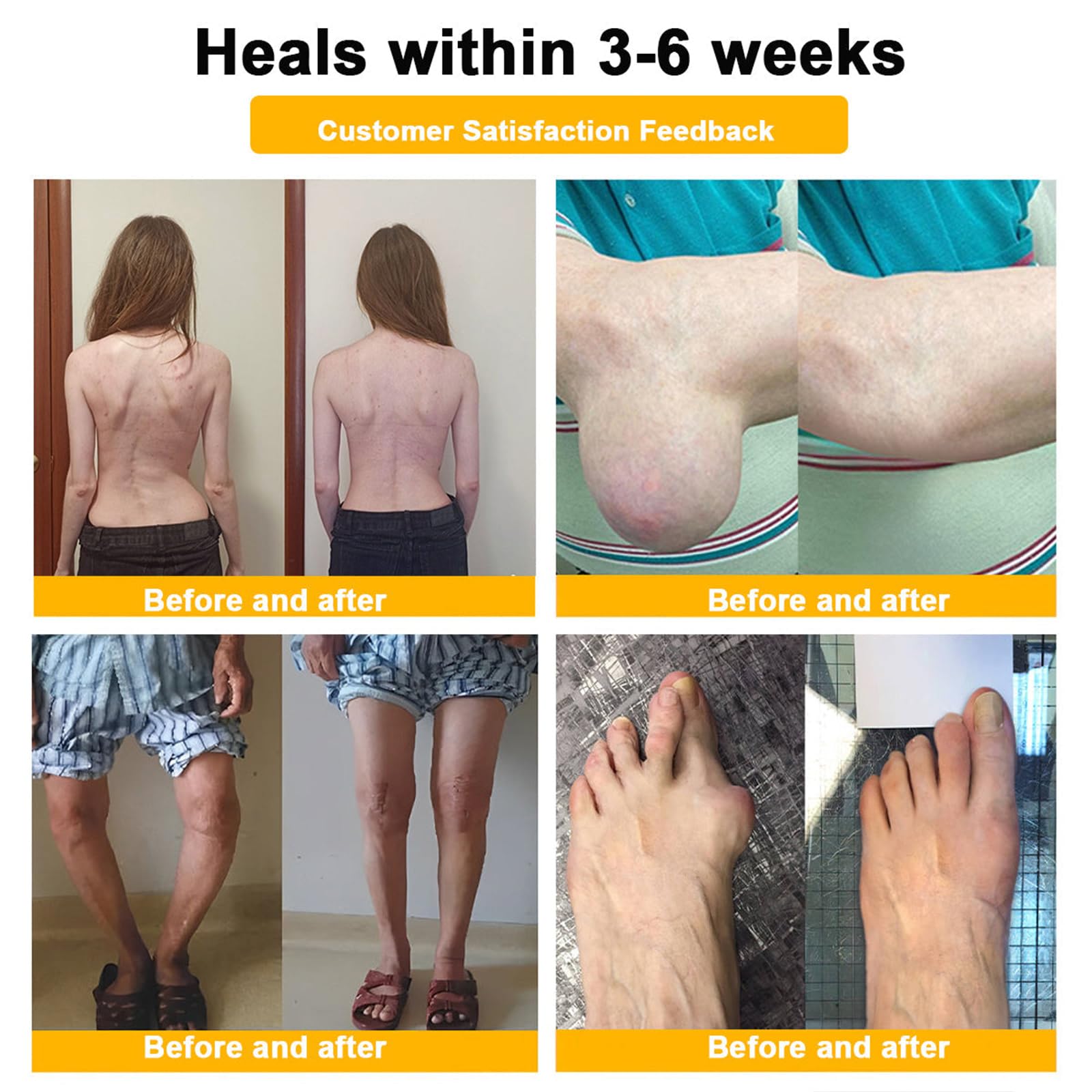Luhaka Botulinum Toxin & Bee Venom Pain-Relief Bone Healing Cream,Bee Venom Cream,Effectively improve joint mobility (1PC) Luhaka Au supplements