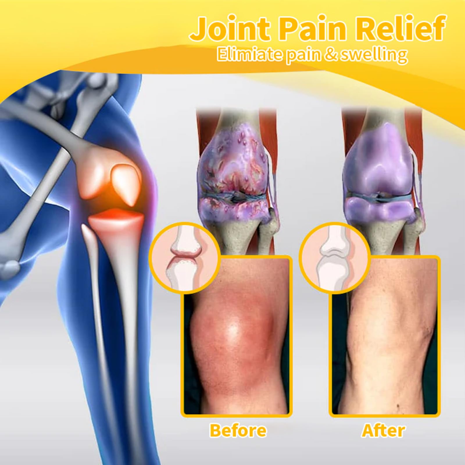 Luhaka Botulinum Toxin & Bee Venom Pain-Relief Bone Healing Cream,Bee Venom Cream,Effectively improve joint mobility (1PC) Luhaka Au supplements