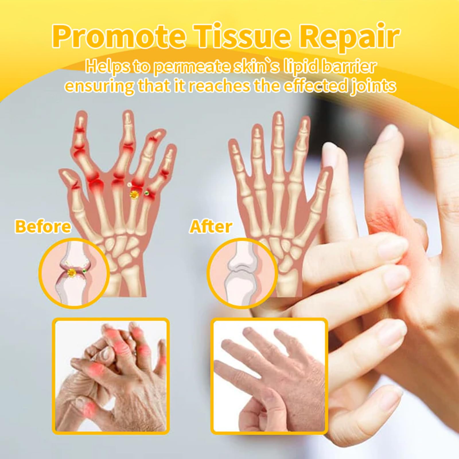 Luhaka Botulinum Toxin & Bee Venom Pain-Relief Bone Healing Cream,Bee Venom Cream,Effectively improve joint mobility (1PC) Luhaka Au supplements