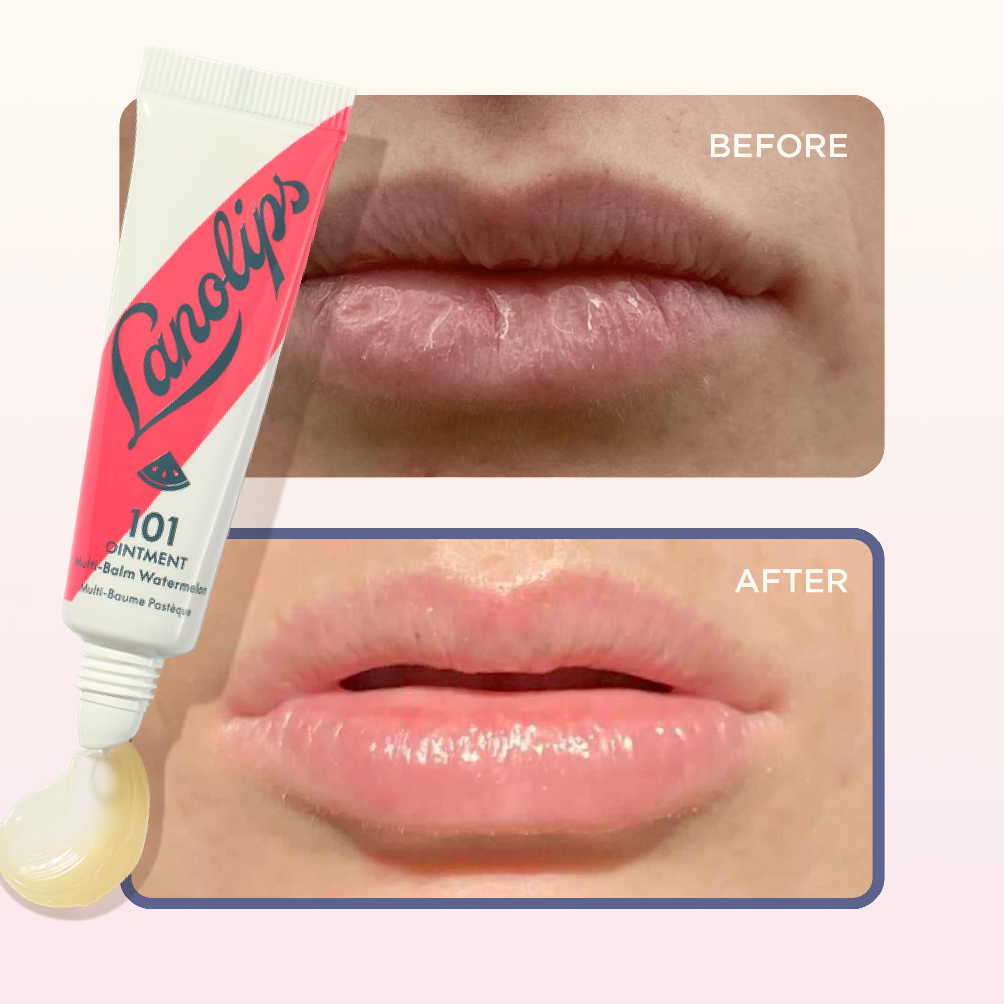 Lanolin 101 Multipurpose Ointment - Lanolin Lip Balm & Healing Ointment for Skin Barrier Repair - Moisturizer for Dry Lips, Cuticles & Elbows - No Petroleum Formula - Watermelon (0.35 oz) Lanolips Au supplements