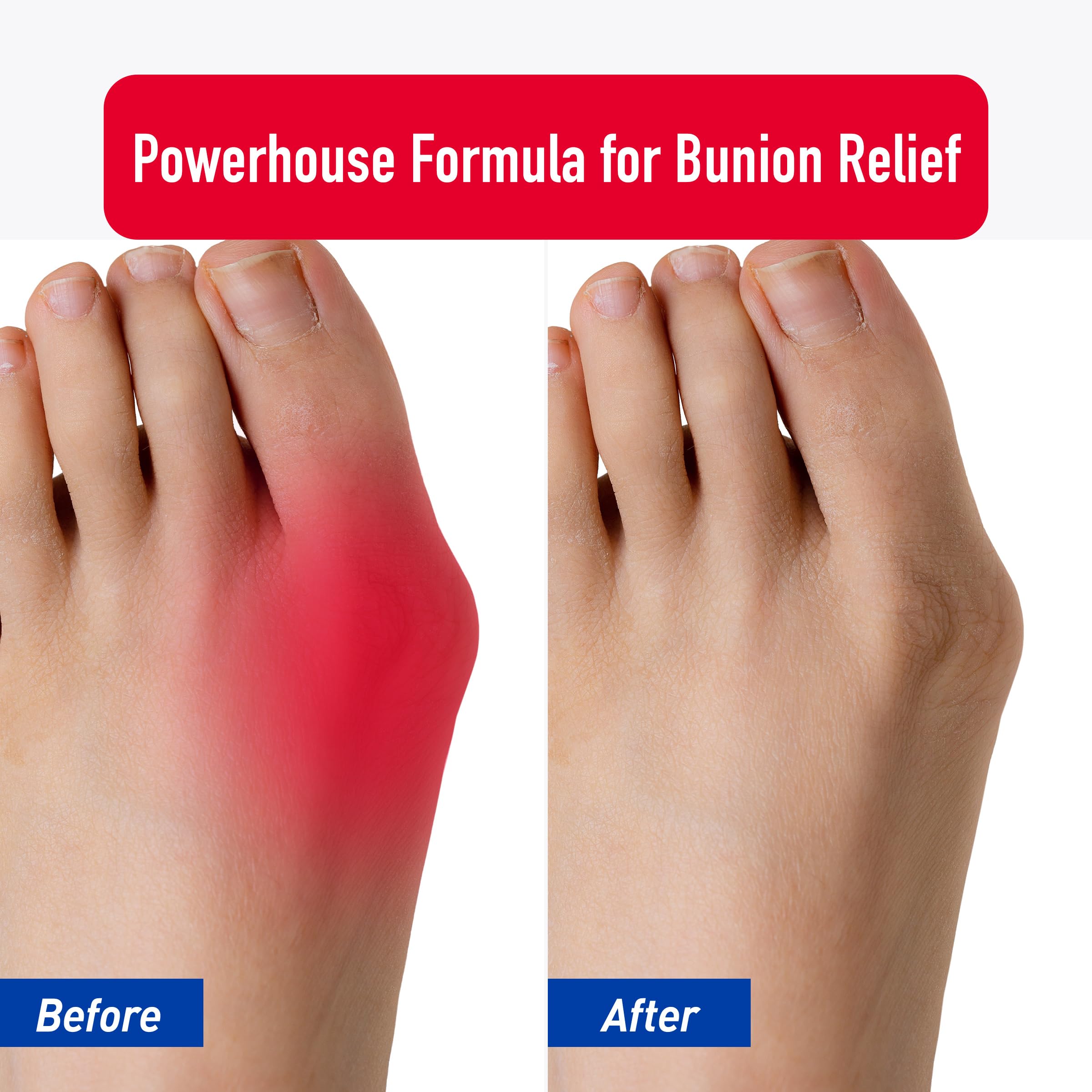 PROFOOT Bunion Relief Rub, White Heal&Rescue Au supplements