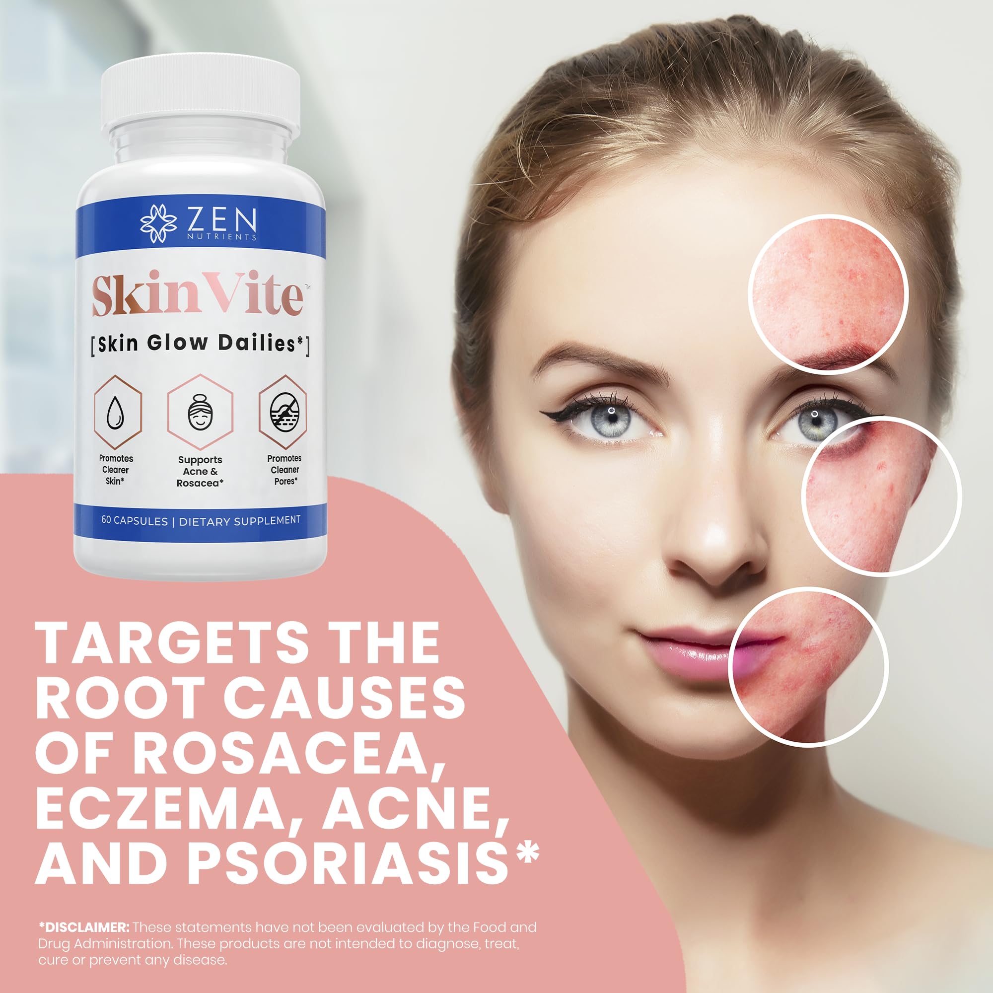 Zen Nutrients SkinVite Natural Skin Supplement for Women, Men & Teens - Hormonal Breakouts & Clear Skin Support Supplement - Detoxifying Vitamin for Acne and Digestion Support Zen Nutrients Au supplements