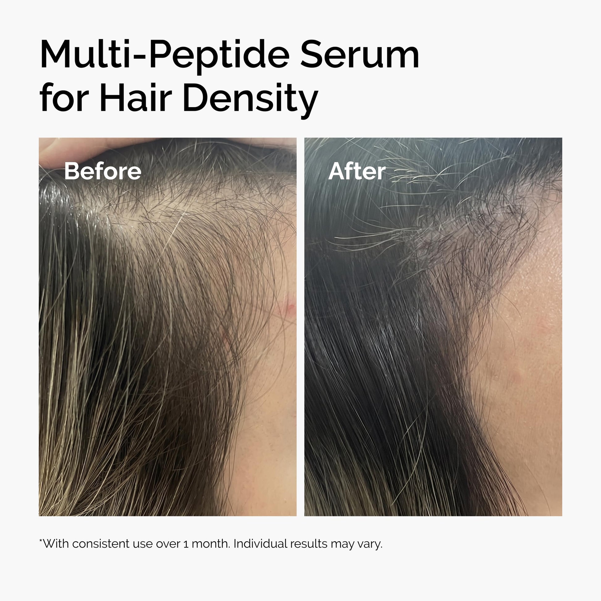 The Ordinary Multi-Peptide Serum for Hair Density, Peptide-Powered Formula for Thicker, Fuller Looking Hair, 2 Fl Oz The Ordinary Au supplements